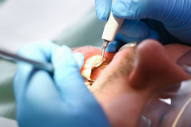 Best Emergency Dental Care for Trauma or Injury in Kingston, IL