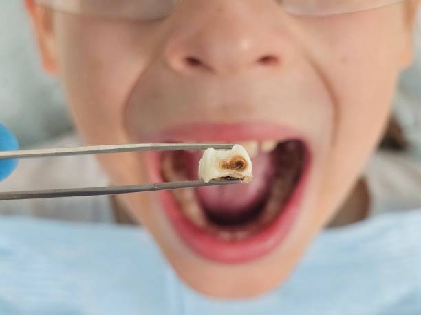 Best After-Hours Emergency Dentist in Kingston, IL